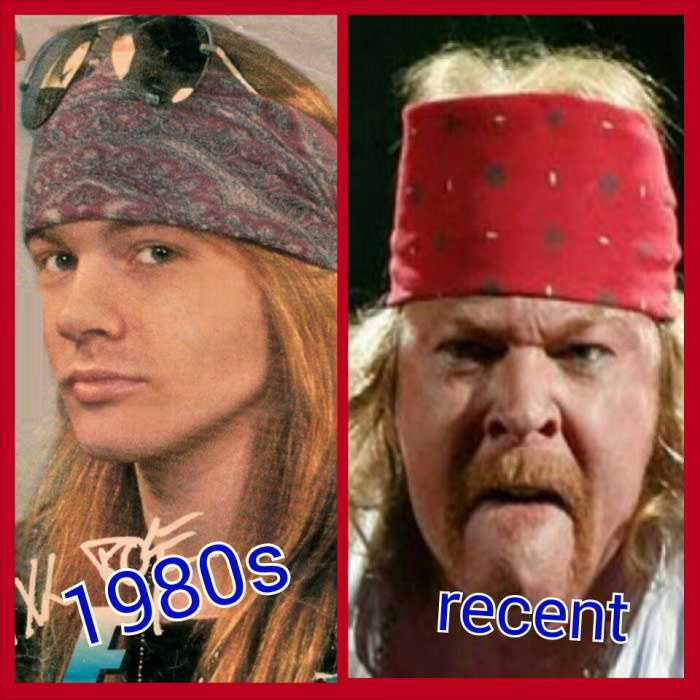 axl rose then and now