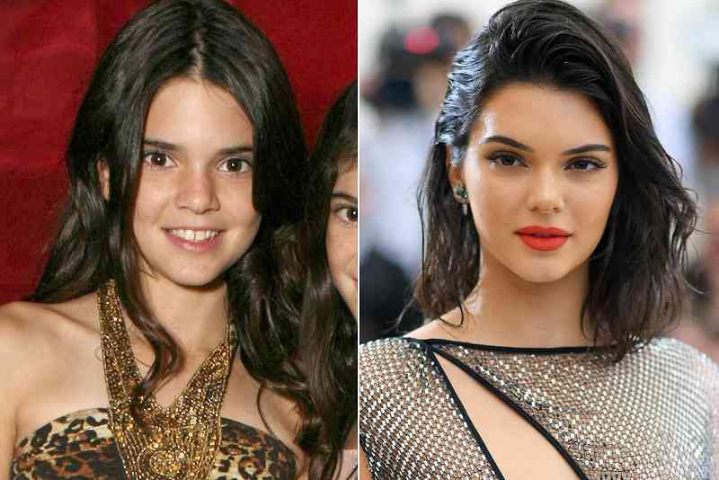 kendall jenner then and now