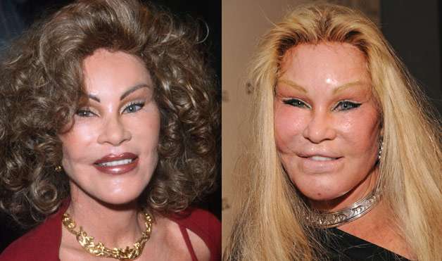 Jocelyn Wildenstein Then And Now