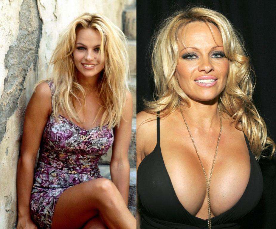 Pamela Anderson Then And Now