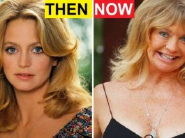 Terribly Aging Celebrities Then And Now Photos