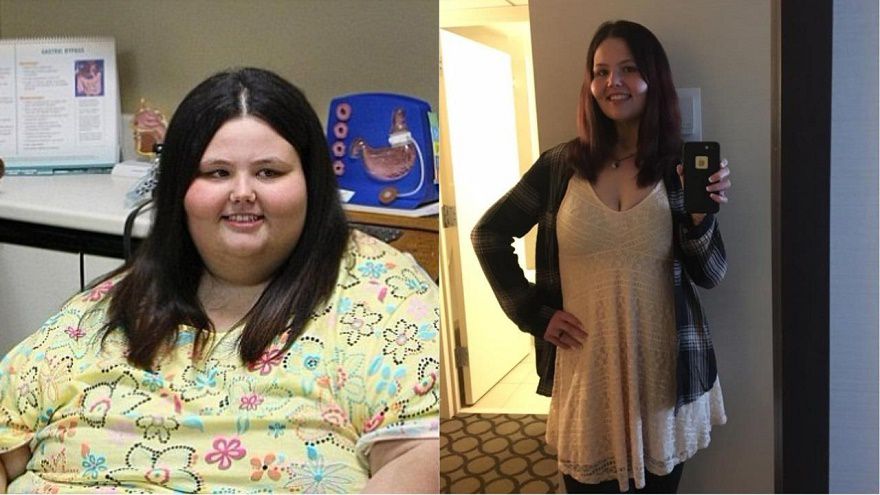 20 Shocking Before And After Weight Loss Photos