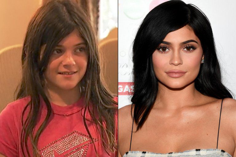 Kylie Jenner Then And Now