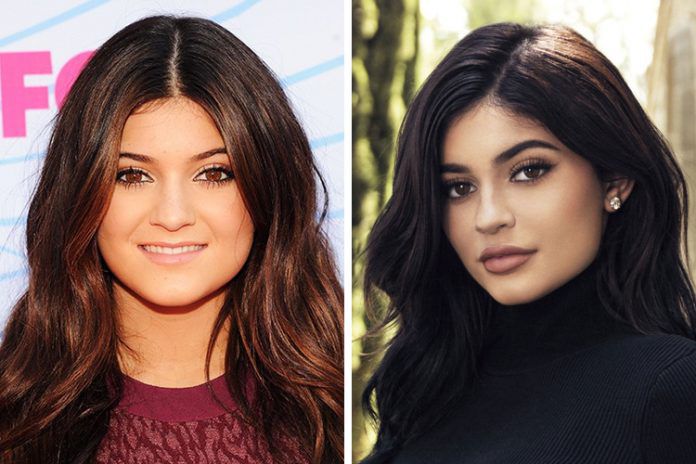 Kylie Jenner Then And Now