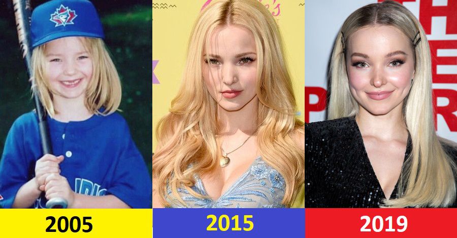 Dove Cameron Then And Now Flawless Beauty Evolution