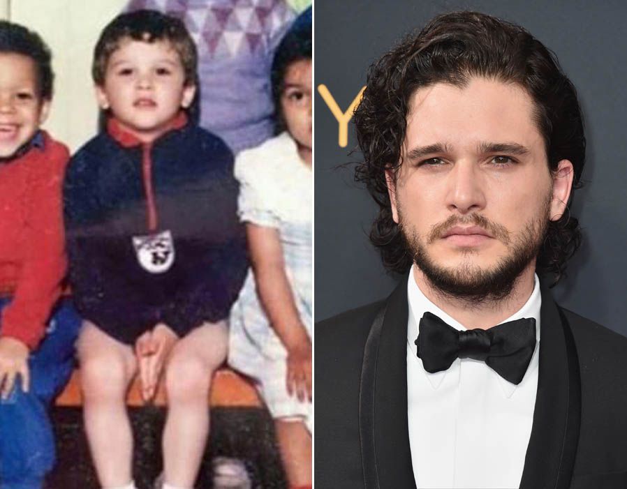 Kit Harington Childhood Vs Now