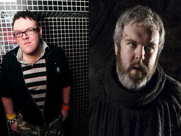 Kristian Nairn Childhood Vs Now