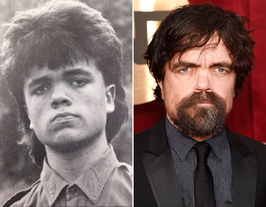 Peter Dinklage Childhood Vs Now