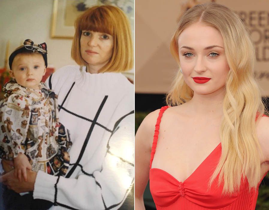 sophie turner Childhood Vs Now