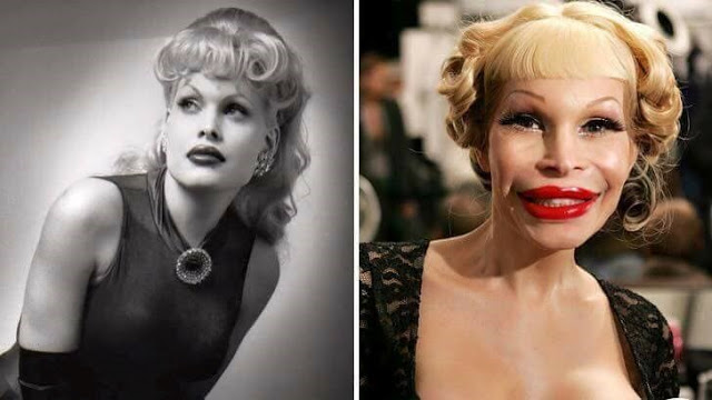 Amanda Lepore Plastic Surgery Gone Wrong