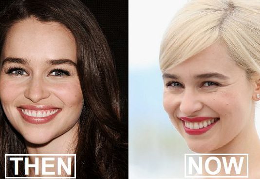 Celebrities Suddenly Changed Their Look