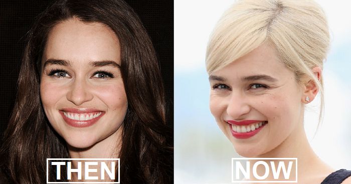 12 Celebrities Who Suddenly Changed Their Look And Are Unrecognizable