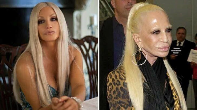 Donatella Versace Plastic Surgery Gone Wrong