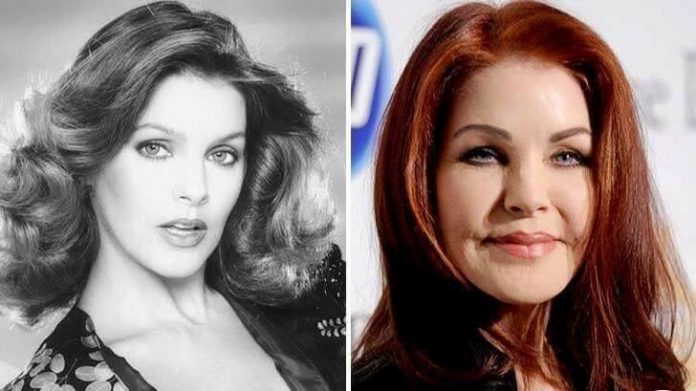 10 Worst Celebrity Plastic Surgery Gone Wrong