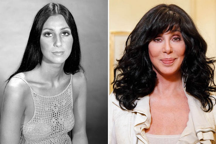 Cher Most Expensive Celebrity Transformations