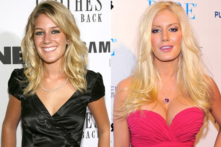 Heidi Montag Most Expensive Celebrity Transformations