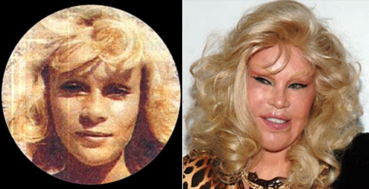 Jocelyn Wildenstein Most Expensive Celebrity Transformations