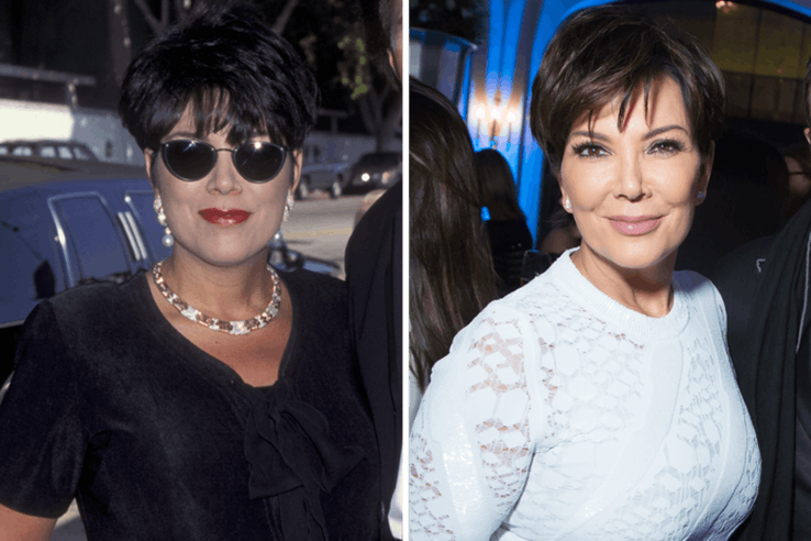 Kris Jenner Plastic Surgery Cost