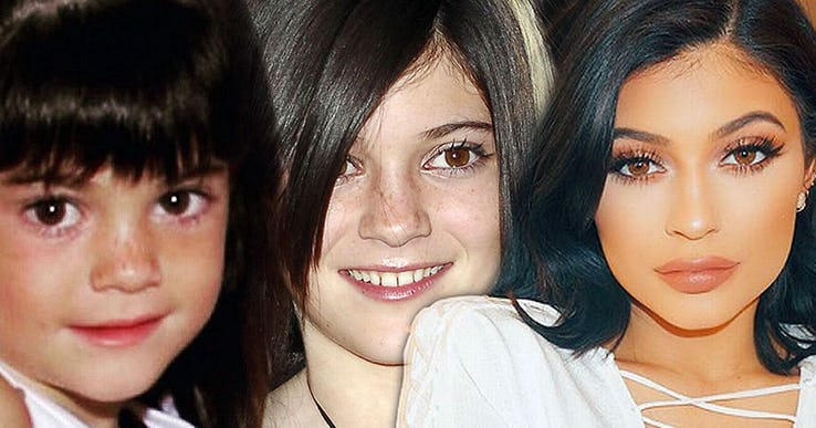 Kylie Jenner Most Expensive Celebrity Transformations