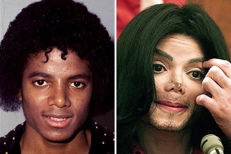 Michael Jackson Most Expensive Celebrity Transformations