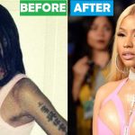 Nicki Minaj Before And After Plastic Surgery