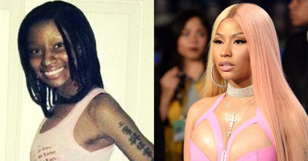 Nicki Minaj Plastic Surgery Cost