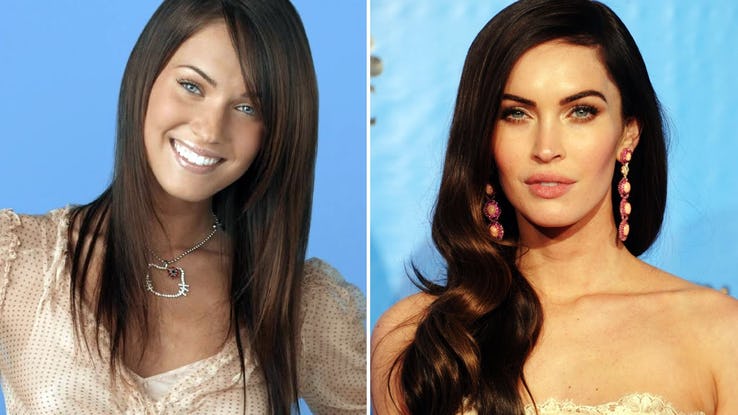 Megan Fox Plastic Surgery Cost